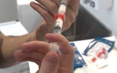 What is Hyperdilute Radiesse? Benefits, Uses & Results