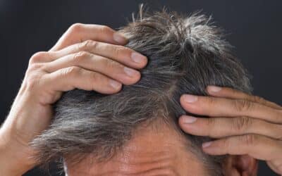 PRP for Male & Female Hair Loss – Does It Work for Everyone?