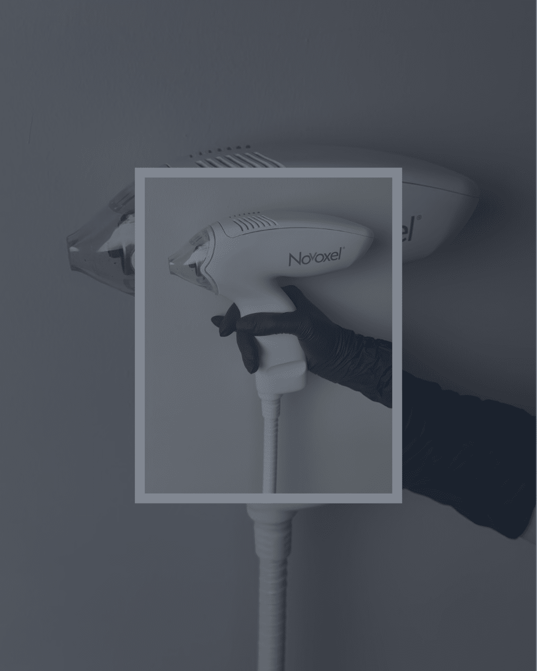 Tixel skin rejuvenation treatment in Hillsborough near Belfast using thermo-mechanical non-laser technology